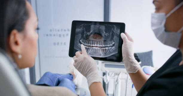 Licensed Wisdom Tooth Removal service in Illinois, IL - Smile Center Dentistry